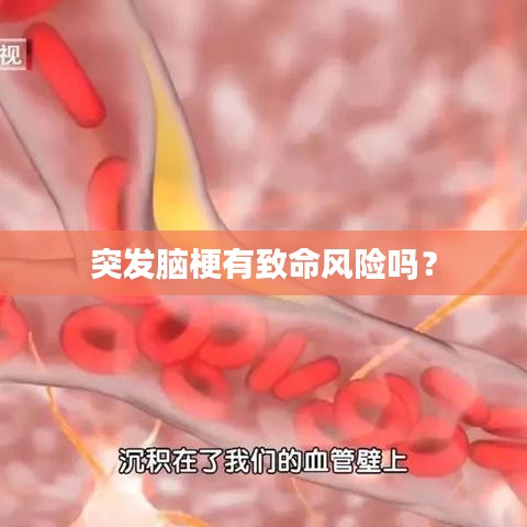 突發腦梗有致命風險嗎？