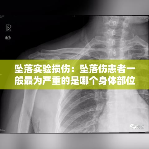 墜落實驗損傷:墜落傷患者一般最為嚴重的是哪個身體部位