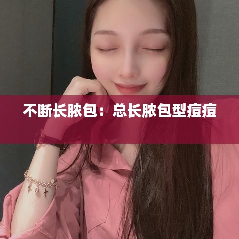 不斷長膿包:總長膿包型痘痘