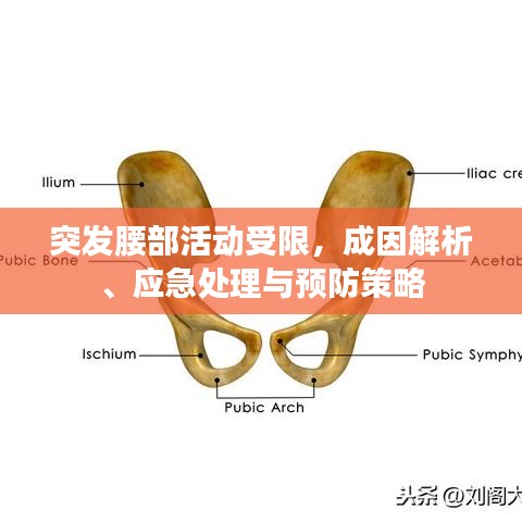 突發腰部活動受限,成因解析、應急處理與預防策略