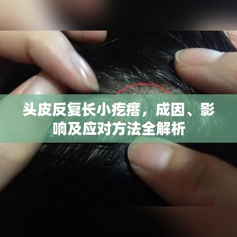 頭皮反復(fù)長小疙瘩,成因、影響及應(yīng)對方法全解析