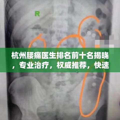 杭州腰痛醫生排名前十名揭曉,專業治療,權威推薦,快速解決您的腰痛問題!