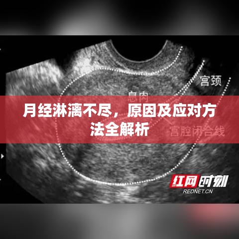 月經淋漓不盡,原因及應對方法全解析